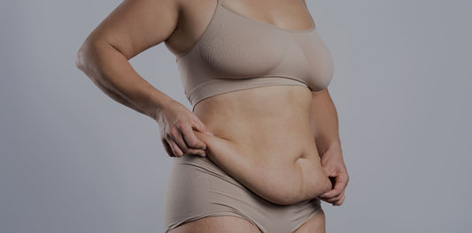 Mujer mostrando su guatita de delantal despues de bajar de peso y despues del embarazo