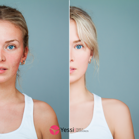 Filtros redes sociales: ¿Deberían las autoridades intervenir? - Tiendas Yessi