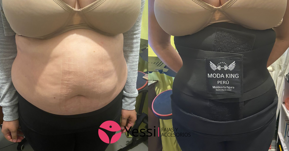Cinturilla ModaKING Negra Velcro - Fajas Reductoras YESSI - Envío Gratis Chile